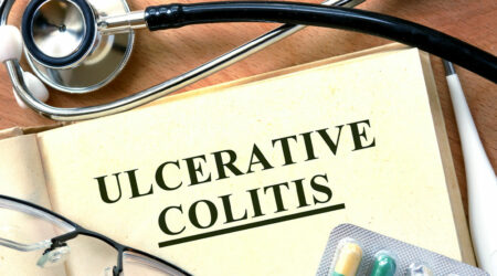 10 Effective Tips for Managing Ulcerative Colitis