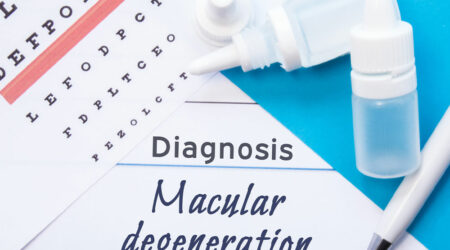 Macular Degeneration – Causes, Symptoms, and More