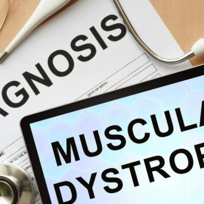 9 common types of muscular dystrophy and their symptoms